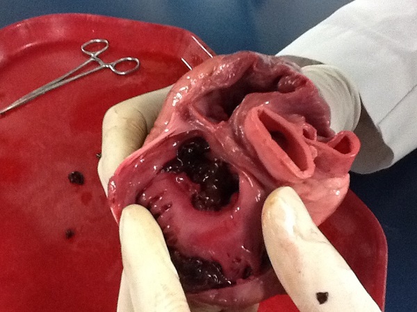 Phương pháp "hồi sinh" trái tim chỉ bằng một mũi tiêm 1