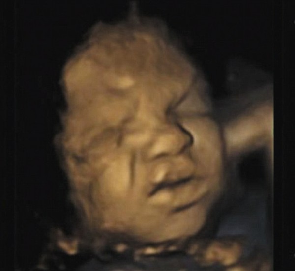 Bất ngờ với hình siêu âm em bé... nhăn mặt trong bụng mẹ 1