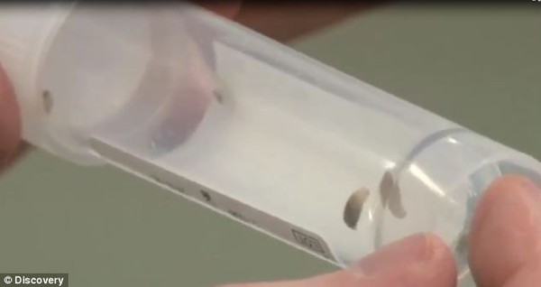 Người phụ nữ bị 14 con gi&ograve;i "ăn thịt người" l&uacute;c nh&uacute;c trong bụng 1