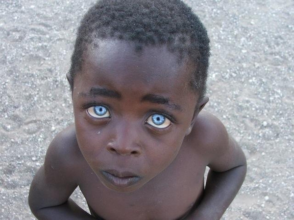 Cậu bé da đen có đôi mắt xanh biếc như đá Sapphire