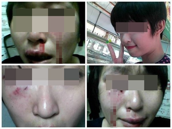 Chia sẻ của c&ocirc; g&aacute;i xinh đẹp bị chồng h&agrave;nh hạ khiến cộng đồng mạng nghẹn ng&agrave;o 1