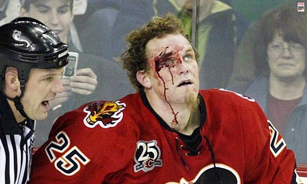 Những “trận chiến” đẫm máu trên sân băng Hockey 13