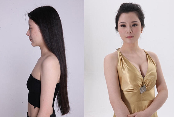 Loạt ảnh các cô gái Trung Quốc trước và sau phẫu thuật thẩm mỹ gây choáng 11
