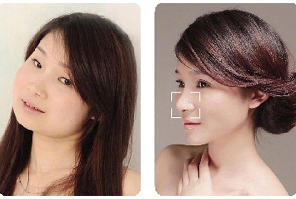 Loạt ảnh các cô gái Trung Quốc trước và sau phẫu thuật thẩm mỹ gây choáng 15