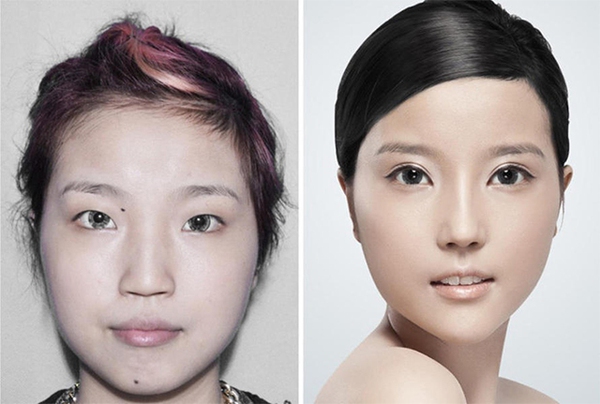Loạt ảnh các cô gái Trung Quốc trước và sau phẫu thuật thẩm mỹ gây choáng 6
