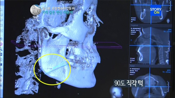 B&agrave; mẹ trẻ đẹp kh&ocirc;ng tưởng sau phẫu thuật thẩm mỹ 6