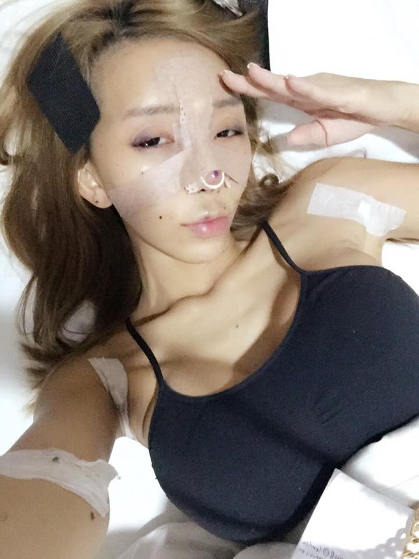 Nữ DJ nổi tiếng Malaysia c&ocirc;ng khai loạt ảnh phẫu thuật thẩm mỹ g&acirc;y sốc 7