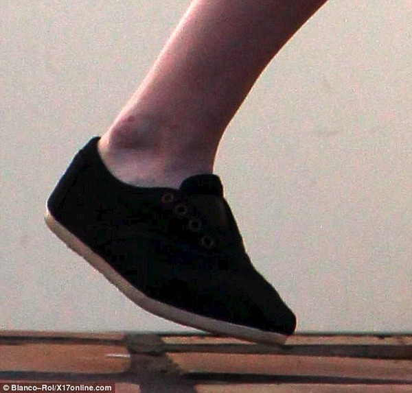 Kristen Stewart khổ sở khập khiễng vì chân đau 2