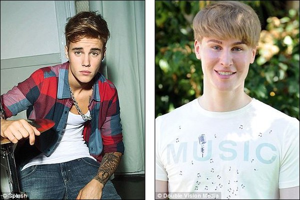 Nhạc sĩ chi hơn 2 tỷ để phẫu thuật giống Justin Bieber 2
