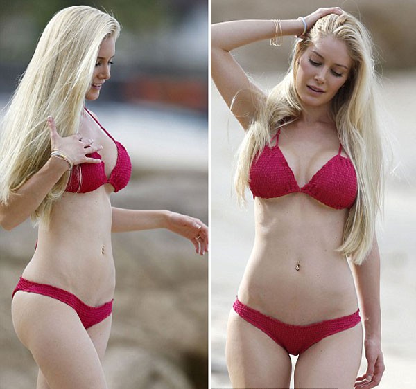 Heidi Montag đau đớn vì bơm ngực quá to 4