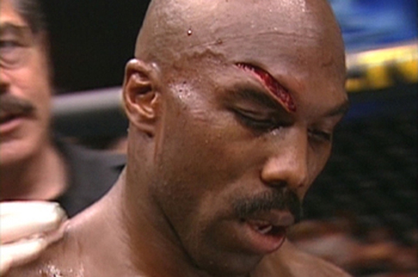 Những chấn thương “rợn người” trong môn võ tổng hợp MMA 4