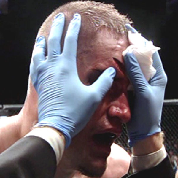 Những chấn thương “rợn người” trong môn võ tổng hợp MMA 8