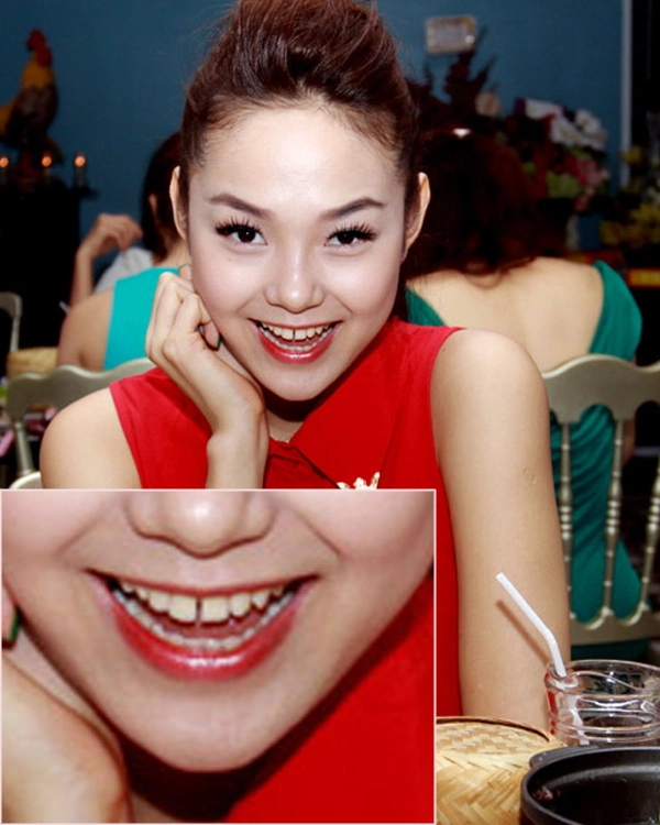 "Bóc trần" nét xấu trên gương mặt mỹ nhân Việt 7