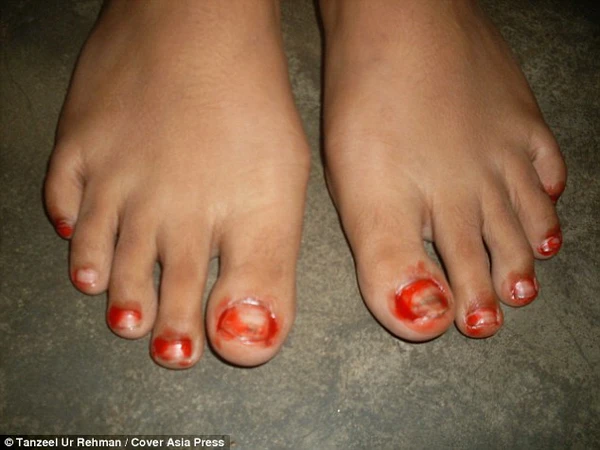 C&ocirc; b&eacute; 15 tuổi người Ấn Độ kh&oacute;c v&agrave; to&aacute;t mồ h&ocirc;i m&aacute;u 2