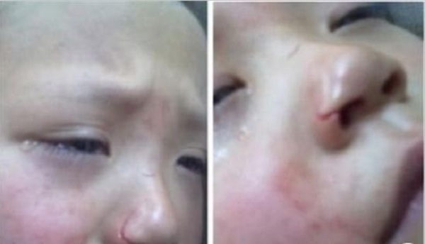 Phẫn nộ c&ocirc; gi&aacute;o d&ugrave;ng k&eacute;o cắt mũi học sinh 2
