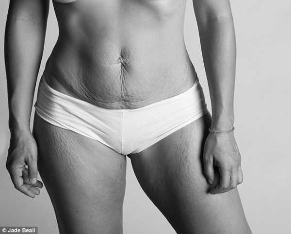 Hình ảnh chân thực về cơ thể của những người phụ nữ sau khi sinh 8