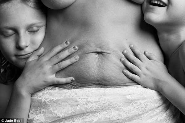 Hình ảnh chân thực về cơ thể của những người phụ nữ sau khi sinh 1