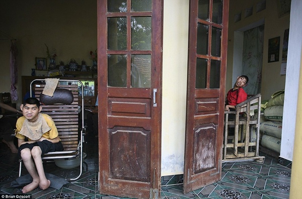 Hình ảnh trẻ em Việt Nam nhiễm chất độc màu da cam trên báo nước ngoài 1