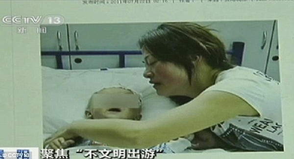 Bé 8 tháng tuổi bị khỉ cắn mất bộ phận sinh dục 1