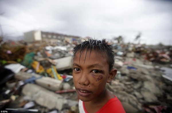 Hình ảnh những đứa trẻ đáng thương trong siêu bão Haiyan  12