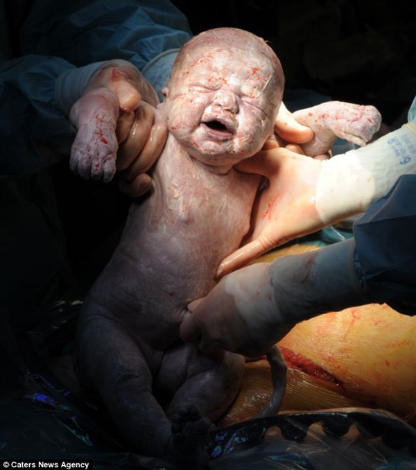 Loạt ảnh ghi lại khoảnh khắc em b&eacute; ch&agrave;o đời g&acirc;y tranh c&atilde;i  1