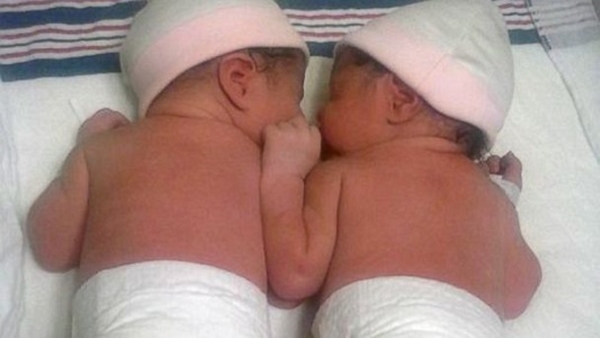 Các cặp song sinh chào đời vào 2 năm khác nhau 2