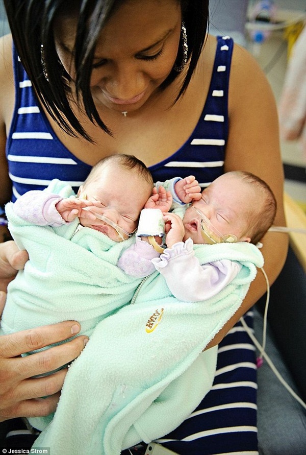 Những hình ảnh vô cùng cảm động trong phòng chăm sóc tích cực cho bé sơ sinh 1