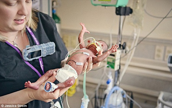 Những hình ảnh vô cùng cảm động trong phòng chăm sóc tích cực cho bé sơ sinh 5