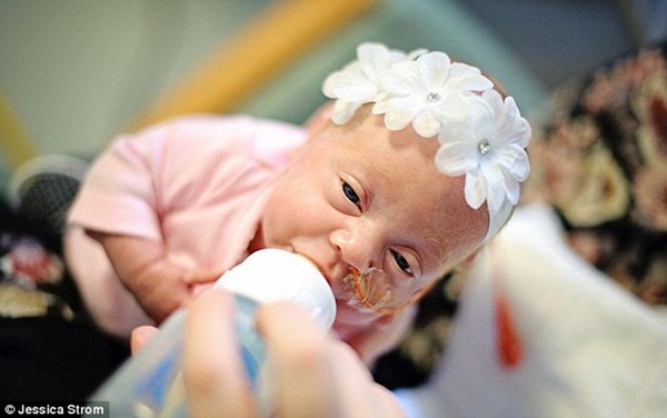 Những hình ảnh vô cùng cảm động trong phòng chăm sóc tích cực cho bé sơ sinh 9