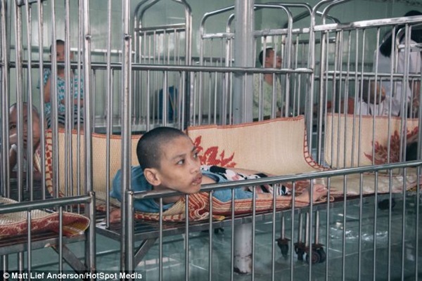 Đau xót hình ảnh trẻ em Việt Nam nhiễm chất độc màu da cam trên báo nước ngoài 7