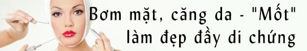 Mổ xẻ “thần dược” nâng mũi không cần phẫu thuật  4