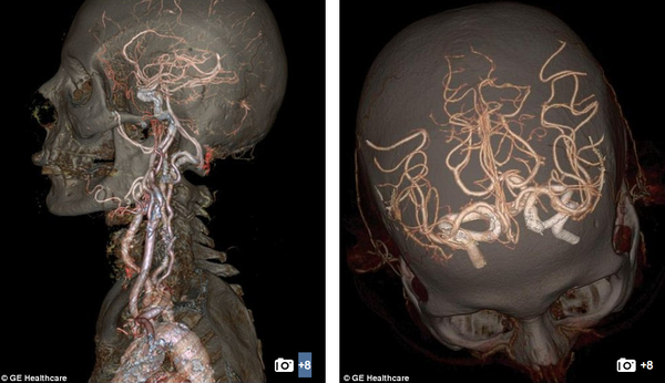 Xem ảnh chụp não, động mạch, tim "động đậy" trong cơ thể người 7