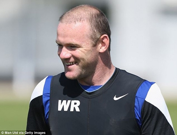 Tóc của Rooney: Vô phương cứu chữa 1