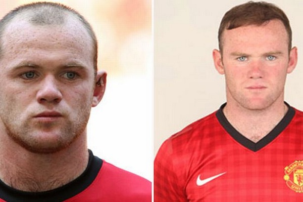 Rooney dính “nghi án” chỉnh sửa thẩm mỹ 3