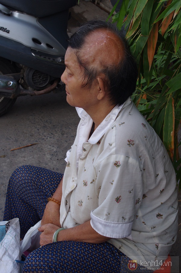 Ho&agrave;n cảnh đ&aacute;ng thương của cụ b&agrave; lượm ve chai chỉ c&ograve;n một nửa bộ n&atilde;o 2