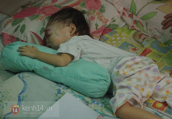 Đau x&oacute;t trước b&agrave;n thờ em b&eacute; mang bệnh ung thư m&aacute;u vẫn c&ograve;n tỉnh t&aacute;o 8
