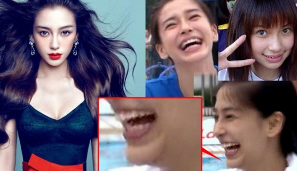 Angela Baby lộ cằm biến dạng trong "Running Man" 1