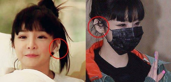 Park Bom (2NE1) được minh oan vụ lấy sụn tai để sửa mũi 1