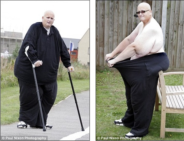 Người đàn ông béo nhất thế giới đã giảm được 285kg 2