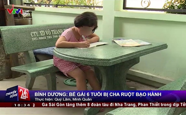 Bình Dương: Bé gái 6 tuổi bị bố ruột dùng lửa đốt khắp người 1