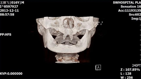 Những h&agrave;m răng kỳ lạ nhất "quả đất" 6