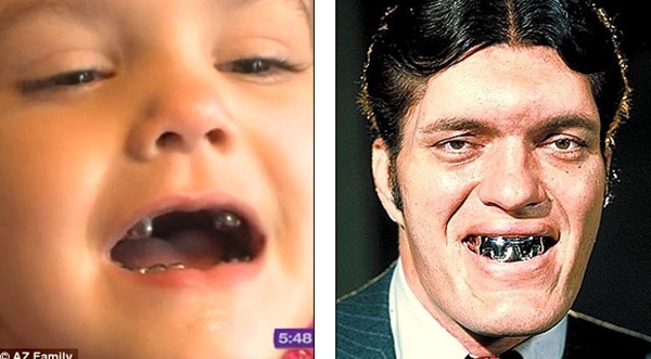 Những h&agrave;m răng kỳ lạ nhất "quả đất" 9