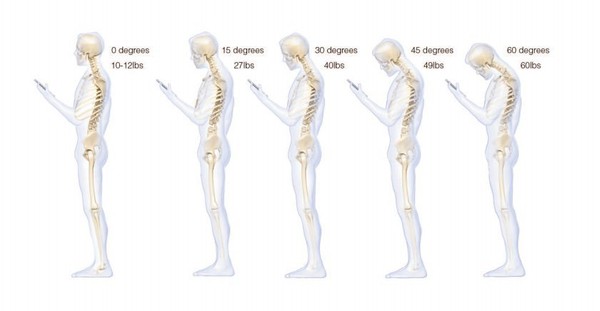 Nghiêng đầu nhiều khi dùng smartphone có thể dẫn tới sụp lưng 1