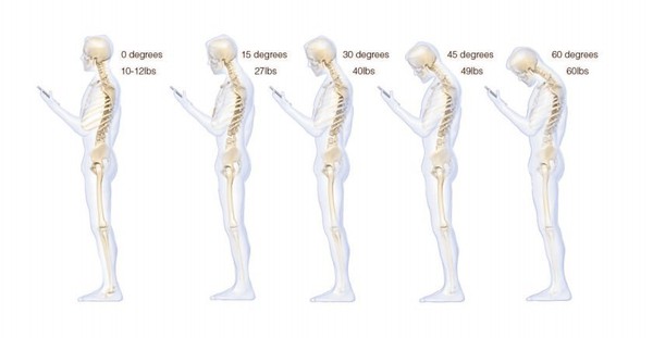 Nghi&ecirc;ng đầu nhiều khi d&ugrave;ng smartphone c&oacute; thể dẫn tới sụp lưng 1