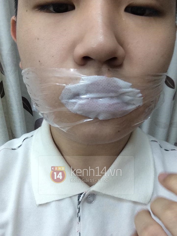 Teen boy Hà Nội công khai quá trình phẫu thuật thẩm mỹ gây sốc 7