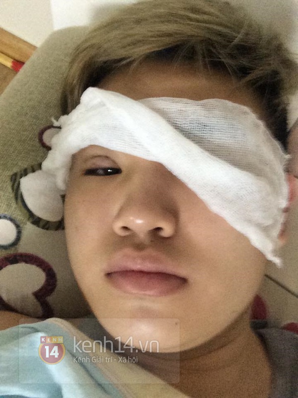 Teen boy Hà Nội công khai quá trình phẫu thuật thẩm mỹ gây sốc 4
