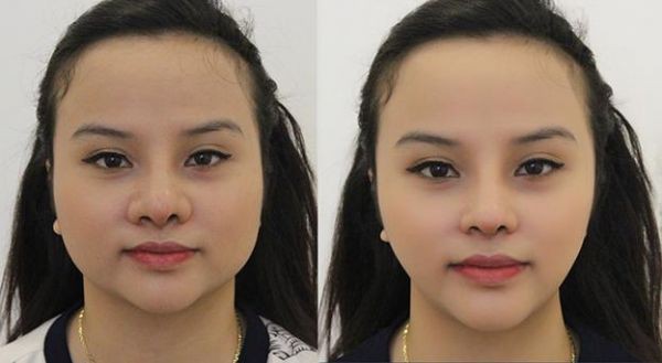 Soi ảnh "con nít" của các hot girl Việt đã công khai phẫu thuật thẩm mỹ 21
