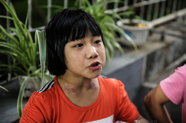 Cận cảnh cuộc sống cơ cực của trẻ em làng cử tạ Trung Quốc 20