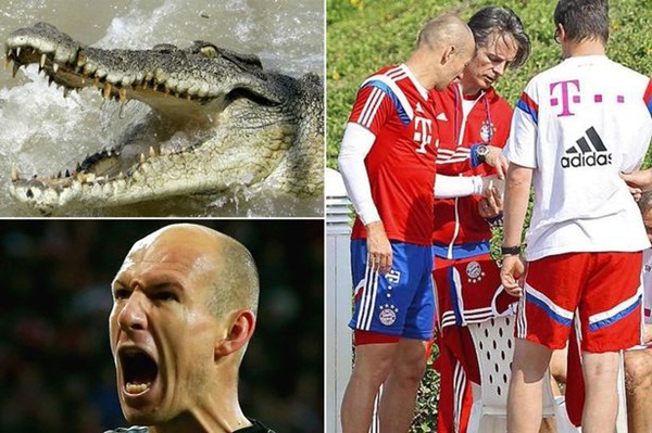 Robben chấn thương vì bị... cá sấu cắn? 1