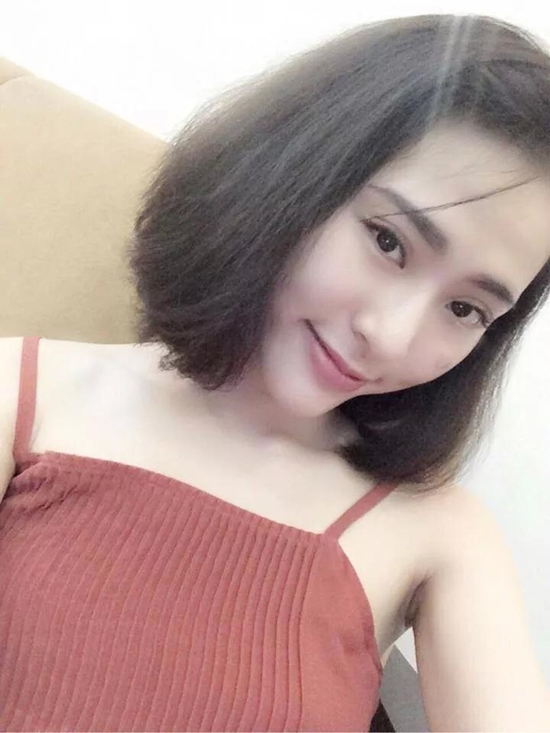 Thiếu nữ Việt "lột xác" xinh đẹp nhờ tiêm filler 6
